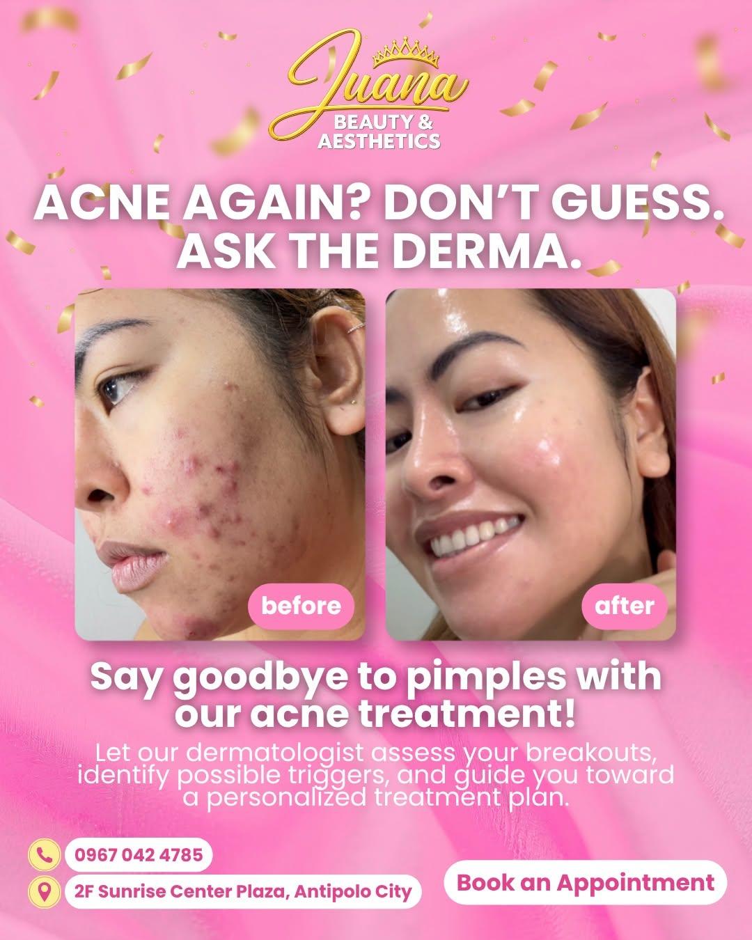 Signature facial